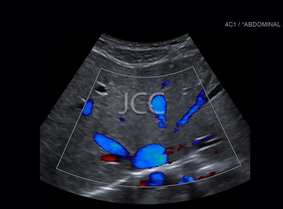 jcc_eco_abdominal_doppler_4.jpg