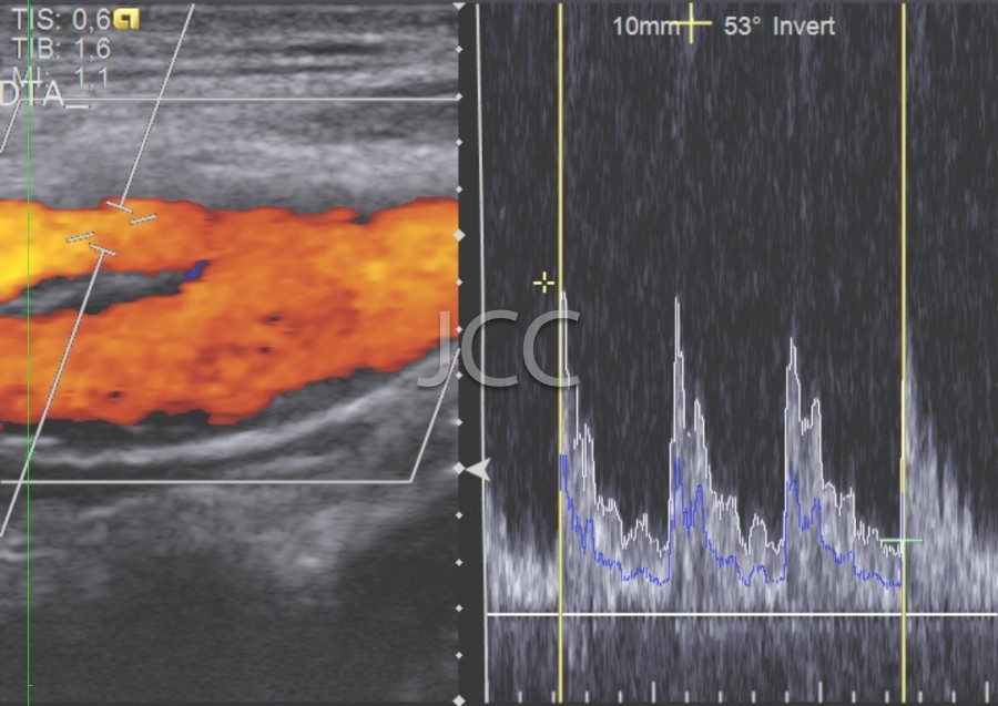 jcc_vascular_doppler_1.jpg