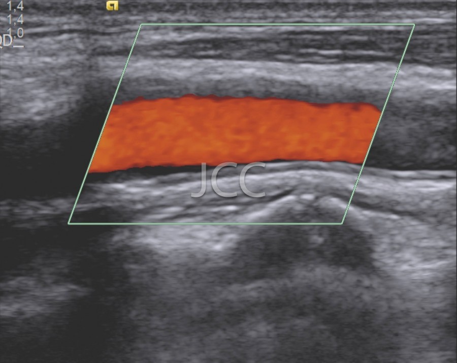 jcc_vascular_doppler_2.jpg
