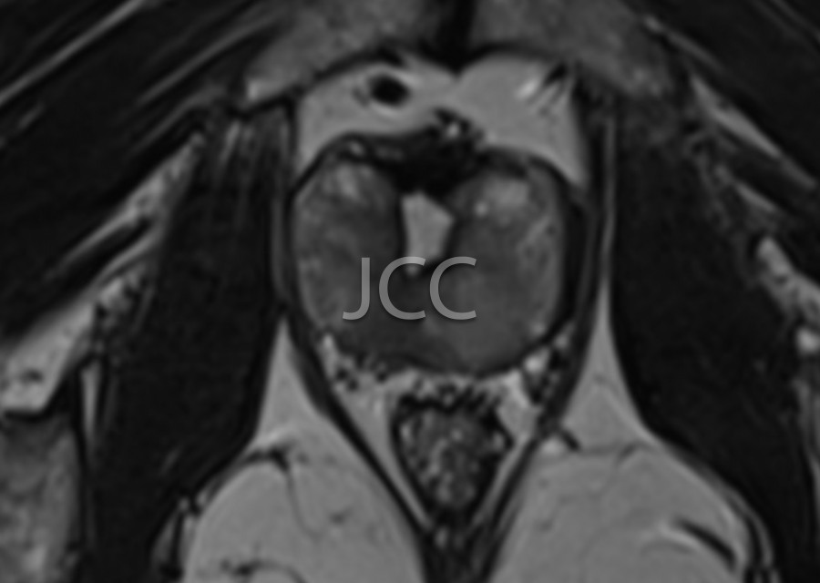 jcc_2.png